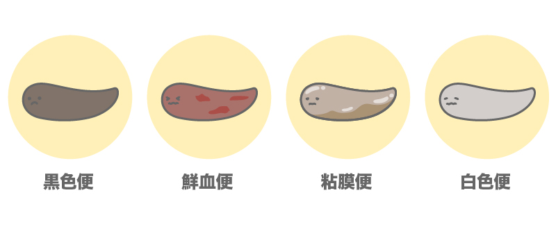 ワンちゃんのウンチの色の違い