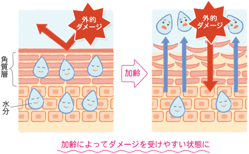 大人のおむつかぶれ 原因と対策 大人用おむつのアテント